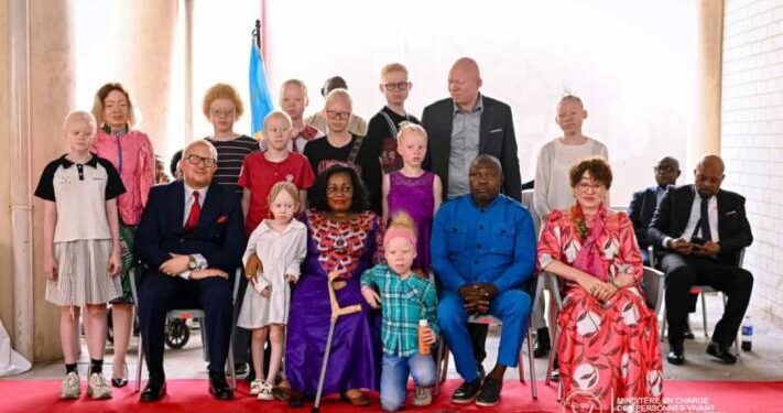 Albinisme : la ministre Esambo réaffirme l’engagement de l’État pour l’inclusion – et les actes attendus