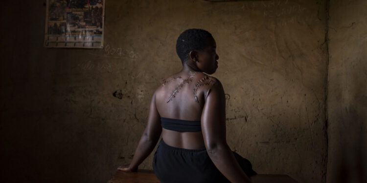 RDC : près de 3 000 violations des droits humains documentées par l’ONU au premier semestre 2026